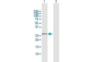 Western Blot analysis of RAB23 expression in transfected 293T cell line by RAB23 MaxPab polyclonal antibody. (RAB23 anticorps  (AA 1-237))