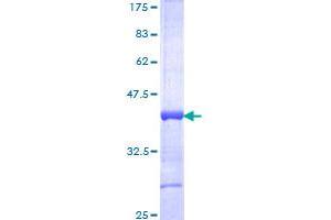 Image no. 1 for Homeobox A13 (HOXA13) (AA 208-306) protein (GST tag) (ABIN1306926)