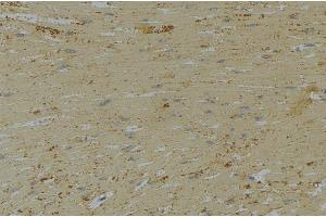 ABIN6269331 at 1/100 staining Mouse muscle tissue by IHC-P.