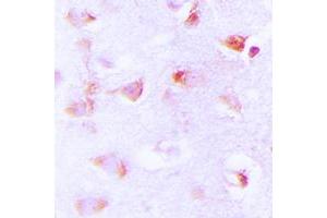 Immunohistochemical analysis of ACC alpha (pS80) staining in human brain formalin fixed paraffin embedded tissue section.