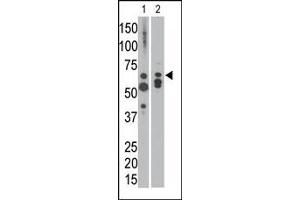 The anti-MTM1 C-term Pab is used in Western blot to detect MTM1 in NCI-H460 cell lysate (lane 1) and in mouse heart tissue lysate (lane 2). (MTM1 anticorps  (C-Term))