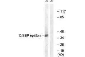 Western blot analysis of extracts from JurKat cells, treated with Insulin 0. (CEBPE anticorps  (AA 40-89))
