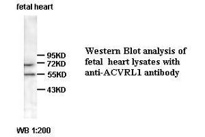Image no. 1 for anti-Activin A Receptor Type II-Like 1 (ACVRL1) (C-Term) antibody (ABIN1099923)