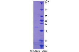 SDS-PAGE of Protein Standard from the Kit  (Highly purified E. (MMP13 Kit ELISA)