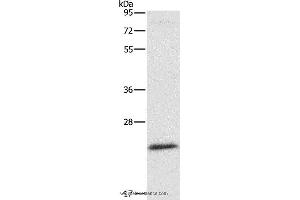 Western blot analysis of Mouse liver tissue, using ATG10 Polyclonal Antibody at dilution of 1:500