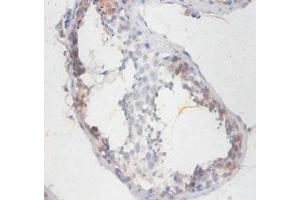 Immunohistochemistry of paraffin-embedded human testis tissue using ABIN7170460 at dilution of 1:100 (SMCP anticorps  (AA 1-116))
