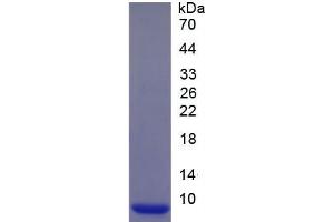 SDS-PAGE of Protein Standard from the Kit (Highly purified E. (CUL9 Kit CLIA)