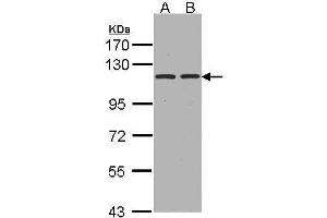 WB Image Sample(30 ug whole cell lysate) A:Hep G2 , B:HeLa S3, 7.