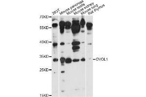 Western blot analysis of extracts of various cell lines, using OVOL1 antibody (ABIN6293430) at 1:1000 dilution. (OVOL1 anticorps)