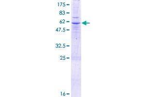 Image no. 1 for Solute Carrier Family 25, Member 40 (SLC25A40) (AA 1-338) protein (GST tag) (ABIN1320298)