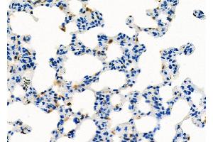 ABIN6260031 and ABIN6273193 at 1/100 staining Rat lung tissue by IHC-P. (ARHGDIB anticorps  (N-Term))