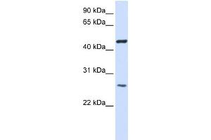 WB Suggested Anti-TMEM127 Antibody Titration:  0. (TMEM127 anticorps  (Middle Region))