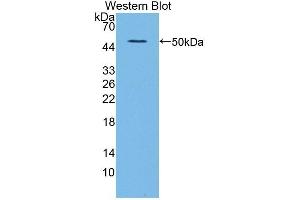 Detection of Recombinant ALDH1A, Human using Polyclonal Antibody to Aldehyde Dehydrogenase 1 Family, Member A2 (ALDH1A2)