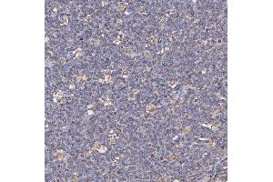 IHC analysis of CD74 using anti-CD74 antibody (ABIN7602385). (CD74 anticorps  (AA 73-296))