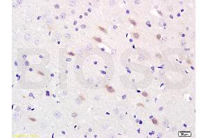 Formalin-fixed and paraffin-embedded : rat brain labeled with Rabbit Anti-NOS-2/iNOS Polyclonal Antibody, Unconjugated (ABIN677228) 1:200 followed by conjugation to the secondary antibody and DAB staining (NOS2 anticorps  (AA 14-100))