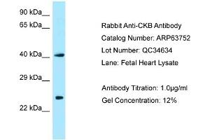 Western Blotting (WB) image for anti-Creatine Kinase, Brain (CKB) (N-Term) antibody (ABIN2789612) (CKB anticorps  (N-Term))