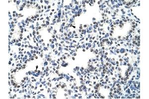 HNRPLL antibody was used for immunohistochemistry at a concentration of 4-8 ug/ml to stain Alveolar cells (arrows) in Human Lung. (HNRPLL anticorps  (N-Term))