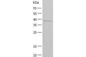 Western Blotting (WB) image for Guanine Nucleotide Binding Protein (G Protein), Q Polypeptide (GNAQ) (AA 1-359) protein (His-IF2DI Tag) (ABIN7123242)