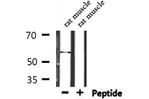 Western blot analysis of extracts from rat muscle, using TPH1  Antibody. (Tryptophan Hydroxylase 1 anticorps  (Internal Region))