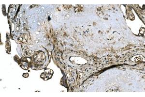 IHC analysis of OTULIN using anti-OTULIN antibody (ABIN7601854). (FAM105B anticorps  (AA 49-352))