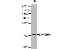 Western blot analysis of K562 cell lysate using EIF4EBP1 antibody. (eIF4EBP1 anticorps  (C-Term))