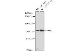 Western blot analysis of extracts of various cell lines using EML2 Polyclonal Antibody at dilution of 1:3000. (EML2 anticorps)