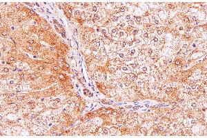 Immunohistochemistry of paraffin-embedded Human liver using IL2 Polyclonal Antibody at dilution of 1:100 (IL-2 anticorps)