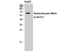 Western Blotting (WB) image for anti-Nuclear Receptor Subfamily 4, Group A, Member 1 (NR4A1) (pSer351) antibody (ABIN3182893) (NR4A1 anticorps  (pSer351))