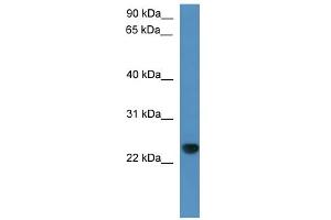 WB Suggested Anti-Capsl Antibody Titration: 0. (CAPSL anticorps  (C-Term))