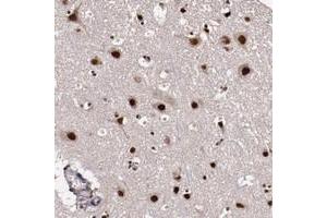 Immunohistochemical staining of human cerebral cortex with CECR2 polyclonal antibody  shows strong nuclear and cytoplasmic positivity in neuronal cells. (CECR2 anticorps)