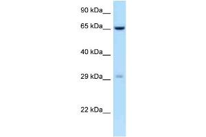 WB Suggested Anti-OSCAR Antibody Titration: 1. (OSCAR anticorps  (C-Term))