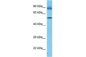 Host:  Rabbit  Target Name:  IFIT3  Sample Tissue:  Human PANC1 Whole Cell  Antibody Dilution:  1ug/ml (IFIT3 anticorps  (N-Term))