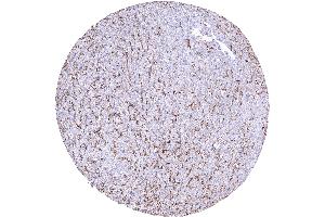 Liver showing a moderate to strong CD38B staining of sinusoidal endothelial cells