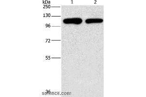Western blot analysis of A431 and hela cell, using PIP5K1C Polyclonal Antibody at dilution of 1:500 (PIP5K1C anticorps)