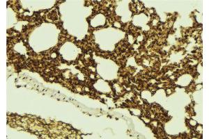 ABIN6273100 at 1/100 staining Mouse lung tissue by IHC-P. (CHMP4B anticorps  (N-Term))
