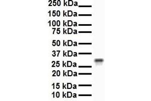 WB Suggested Anti-ECHDC2 antibody Titration: 1 ug/mL Sample Type: Human 721_B (ECHDC2 anticorps  (Middle Region))