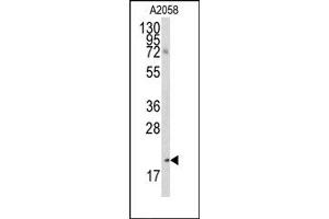 Image no. 1 for anti-Bcl2 Modifying Factor (BMF) (AA 130-150), (BH3 Domain) antibody (ABIN356819) (BMF anticorps  (BH3 Domain))