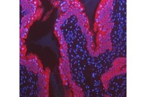IF analysis of Cytokeratin 8/KRT8 using anti-Cytokeratin 8/KRT8 antibody (ABIN5518853).