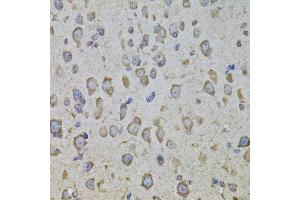 Immunohistochemistry of paraffin-embedded mouse brain using CRHR1 antibody.