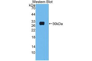 Western blot analysis of the recombinant protein. (MBL2 anticorps  (AA 19-244))