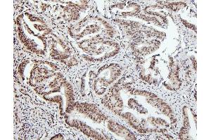 IHC analysis of PTBP1 using anti-PTBP1 antibody (ABIN7599451).