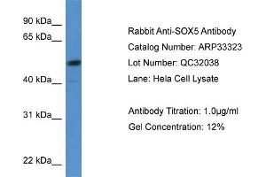 WB Suggested Anti-SOX5 Antibody Titration:  0.