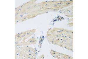 Immunohistochemistry of paraffin-embedded mouse heart using LEPREL2 antibody (ABIN6293155) at dilution of 1:200 (40x lens).