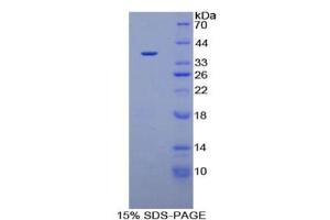 SDS-PAGE of Protein Standard from the Kit (Highly purified E. (PLG Kit ELISA)