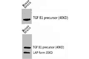 Western Blot analysis of mouse-brain using TGFβ1 Polyclonal Antibody. (TGFB1 anticorps  (C-Term))