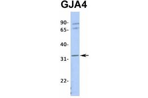 Host:  Rabbit  Target Name:  GJA4  Sample Type:  721_B  Antibody Dilution:  1. (GJA4 anticorps  (Middle Region))