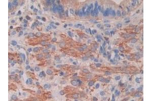 Detection of PDK4 in Mouse Uterus Tissue using Polyclonal Antibody to Pyruvate Dehydrogenase Kinase 4 (PDK4)