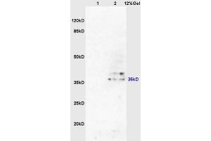 Lane 1: mouse pancreas lysates Lane 2: mouse brain lysates probed with Anti AKR1A1 Polyclonal Antibody, Unconjugated (ABIN872733) at 1:200 in 4 °C.