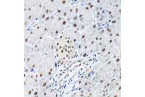 Immunohistochemistry of paraffin-embedded mouse pancreas using KPN Rabbit pAb (ABIN6131812, ABIN6142991, ABIN6142992 and ABIN6224371) at dilution of 1:100 (40x lens). (KPNA3 anticorps  (AA 1-210))