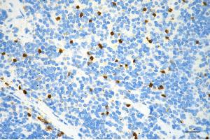 anti-Annexin A1 (ANXA1) antibody